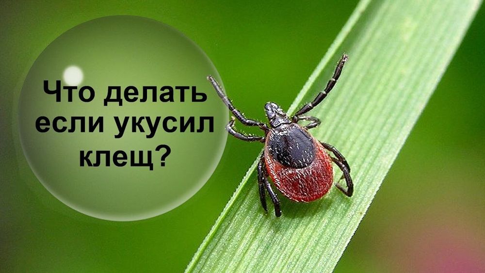 Что делать, если укусил клещ?.